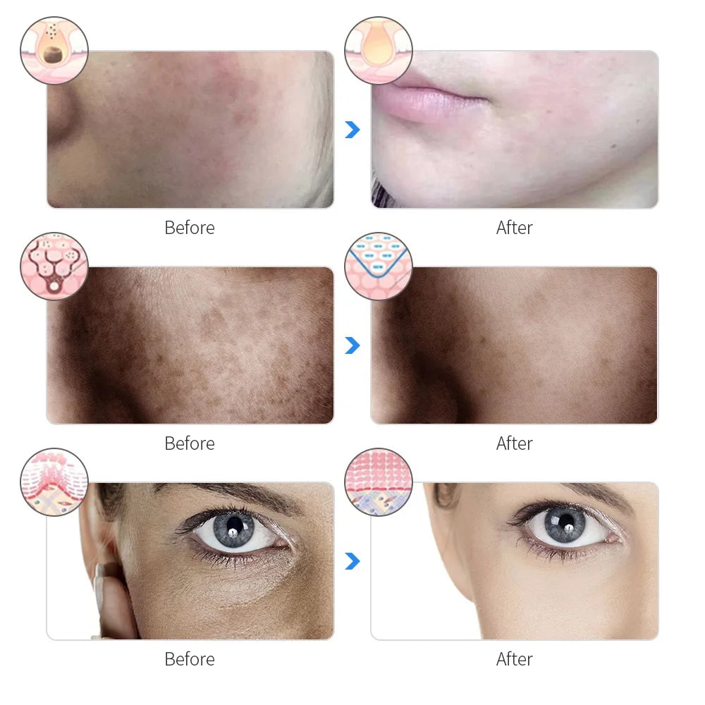 Advanced 7-Color LED Mask for Skin Therapy & Rejuvenation